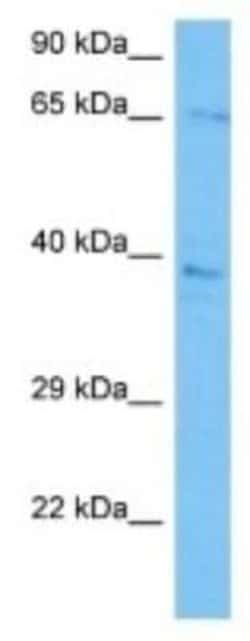PHACTR2 Rabbit anti-Human, Polyclonal, Novus Biologicals:Antibodies:Primary